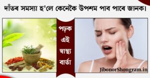 Health Tips In Assamese