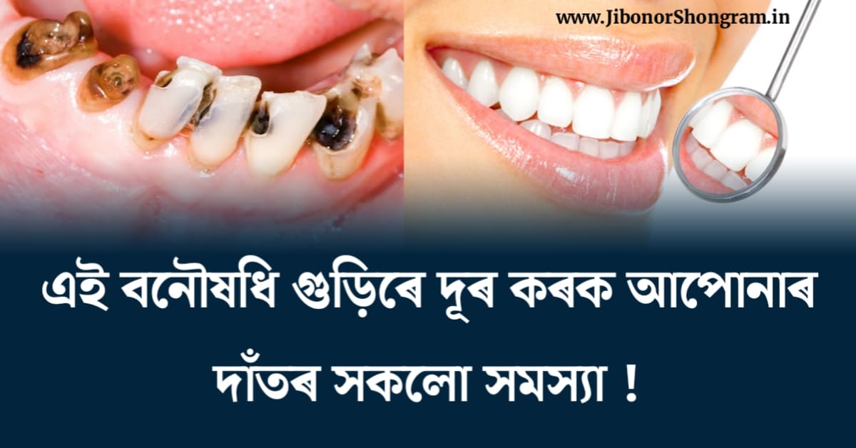 Remove all your dental problems with this herbal powder